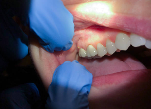 Best Walk-In Emergency Dentist in Yountville, CA